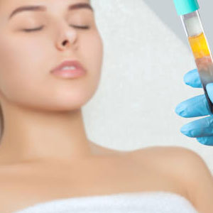 PRP Facial