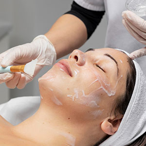 Chemical Peels